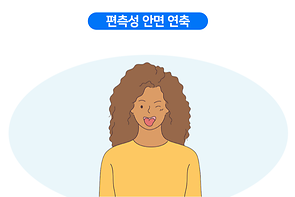 편측성 안면 연축